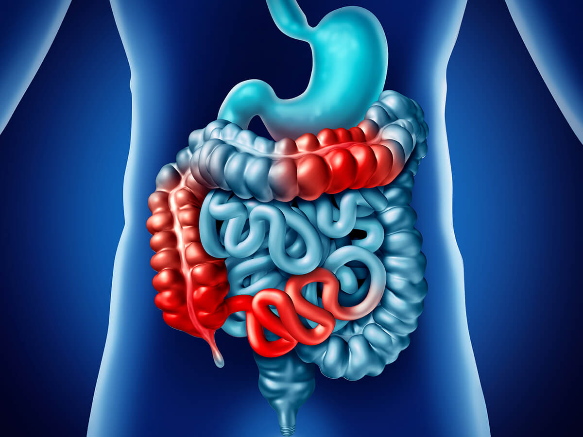 Crohn's Disease & Colitis  Associated Gastroenterology in Orange